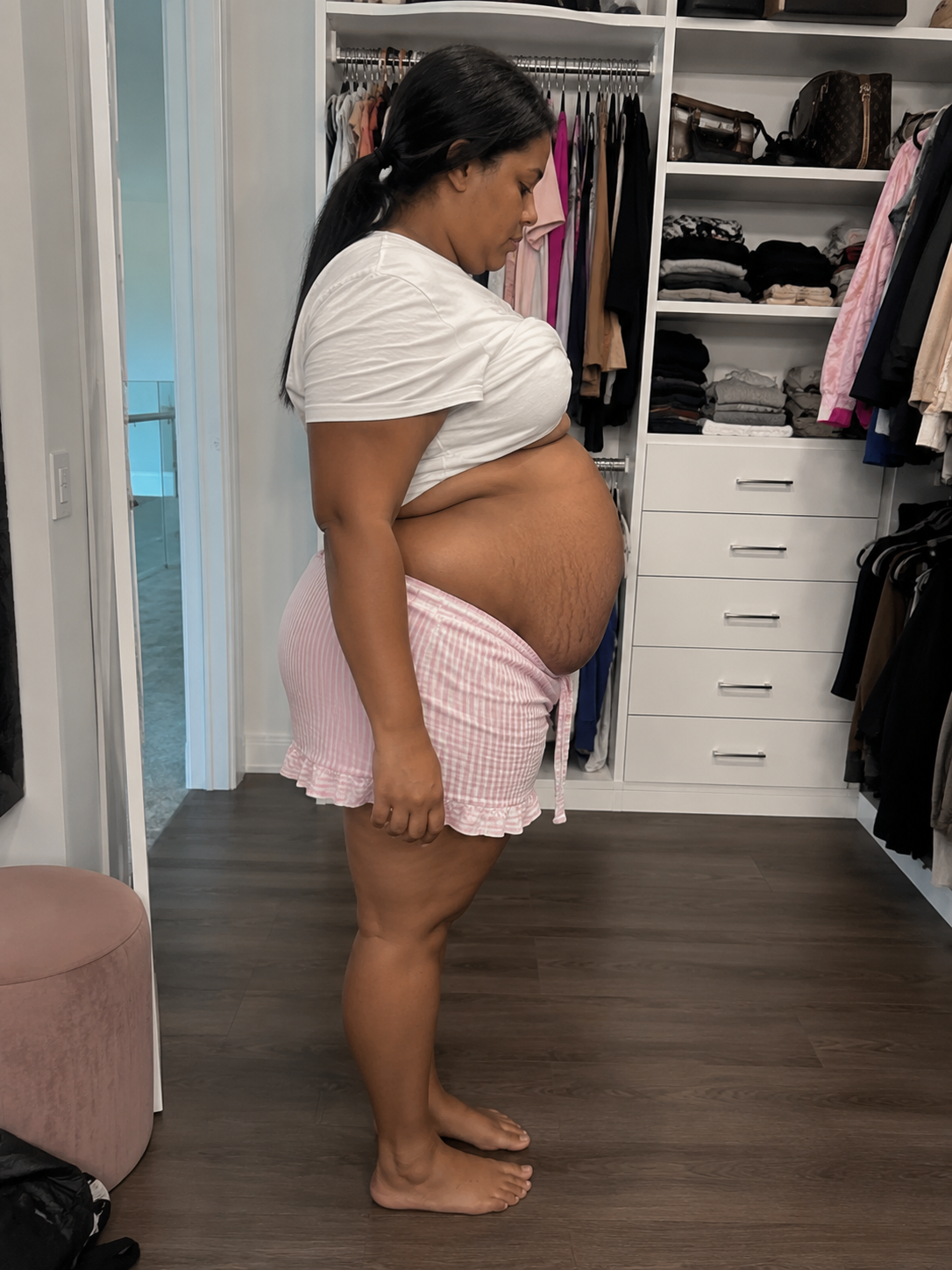 Daniela postpartum side profile before ZENTRA wearing pink shorts